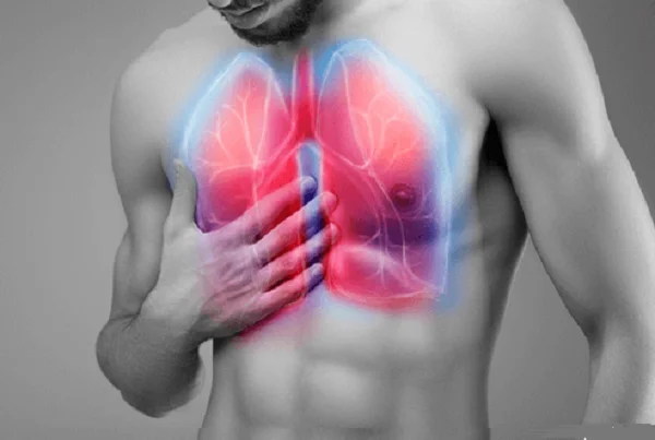 Pneumothorax