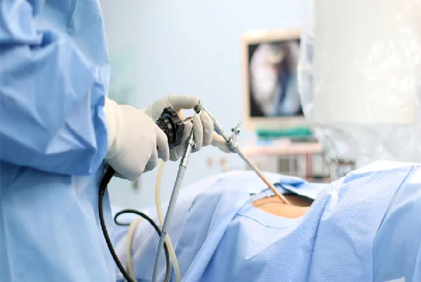 Video Thoracoscopy