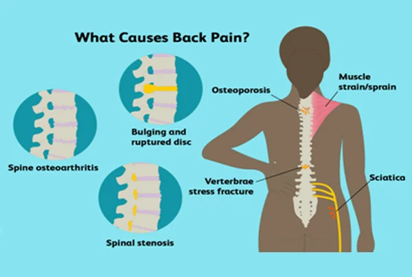 Back Pain